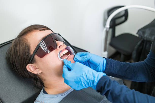 Best Knocked-Out Tooth (Avulsed Tooth) Treatment in New Bremen, OH